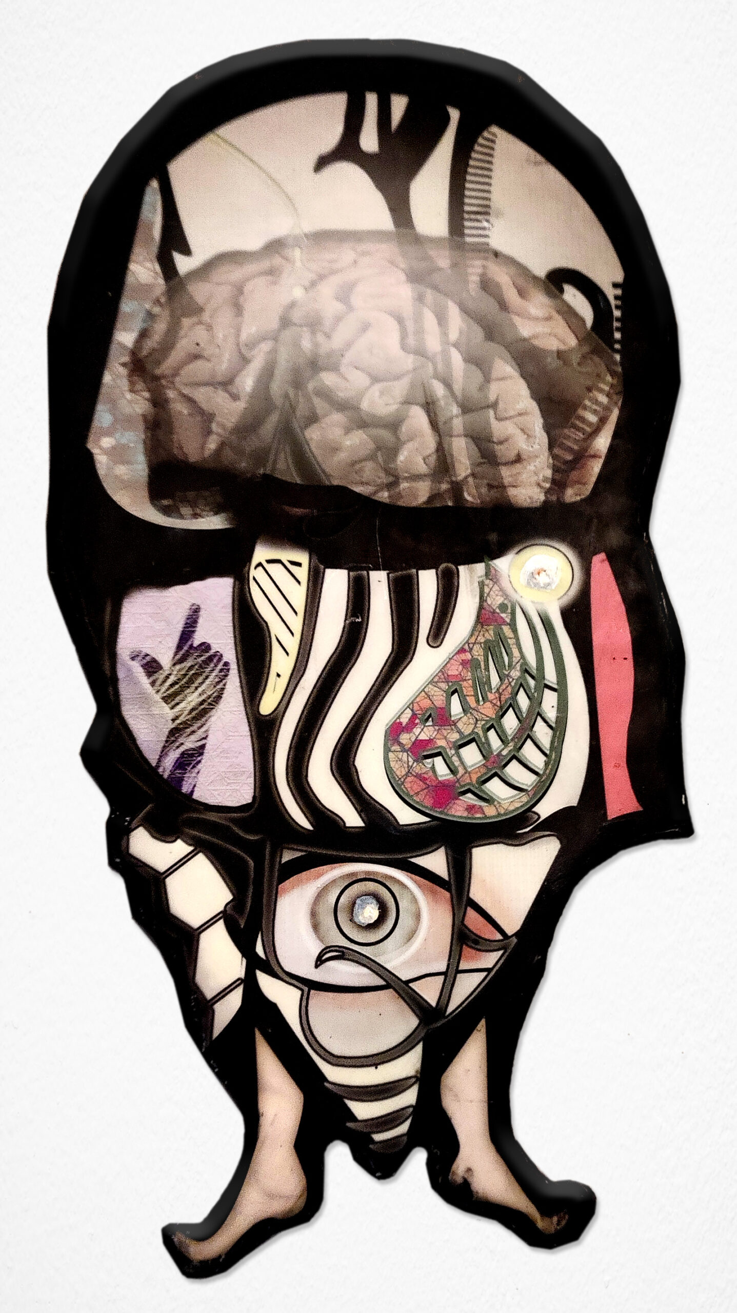 Brainlien
